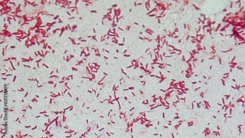 Red bacterial cells under microscope magnification on glass, a fixed sample of bacterial culture. photo