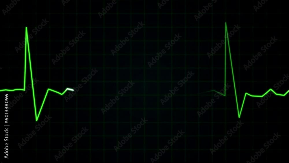 Stockvideo flatline ekg heart monitoring motion design vfx emergency