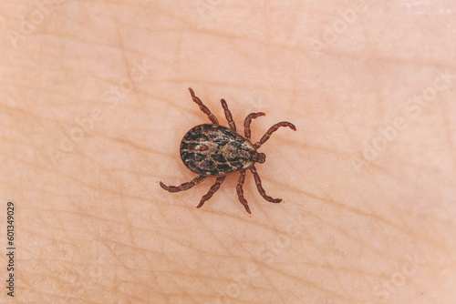 small brown insect mite crawls on human skin causing the risk of infection various infectious diseases such as encephalitis, Lyme disease. the view from top
