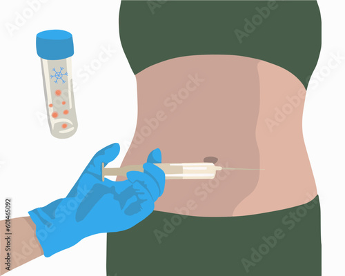 Vector isolated illustration of ovulation stimulation process. Egg donation. Ovary stimulation. Egg freezing. Artificial insemination. photo