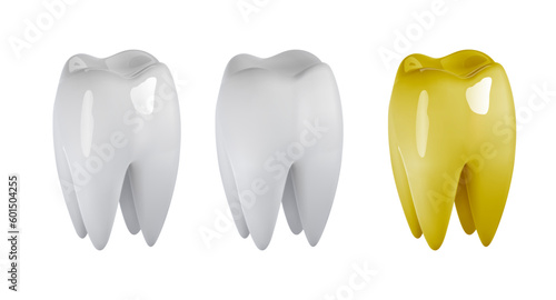 Molar teeth implant, bridge or veneer treatment for missing tooth surgery restoration. Artificial prosthesis or oral crown as row gap filling.
