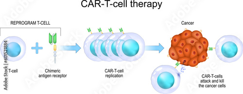 CAR T-cell therapy. cancer immunotherapy. photo