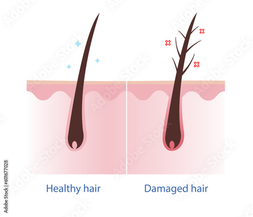 Healthy hair and damaged hair with scalp layer vector on white background. Hair care concept illustration.