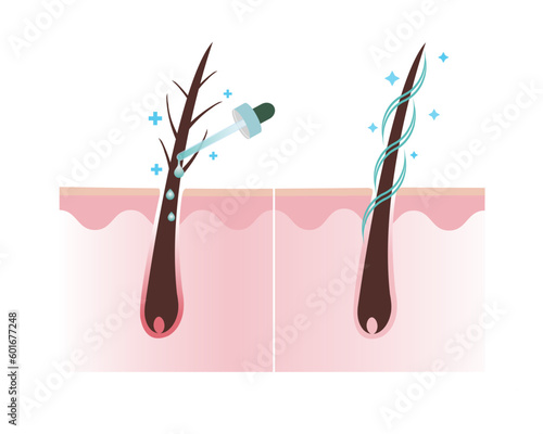 Treat damage hair with treatment and healthy hair scalp layer vector on white background. Hair care concept illustration.