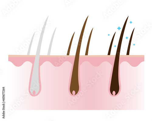 Reduce white, gray hair and make hair darker with scalp layer vector isolated on white background. Solution for greying and darkening hair. Hair care concept illustration.