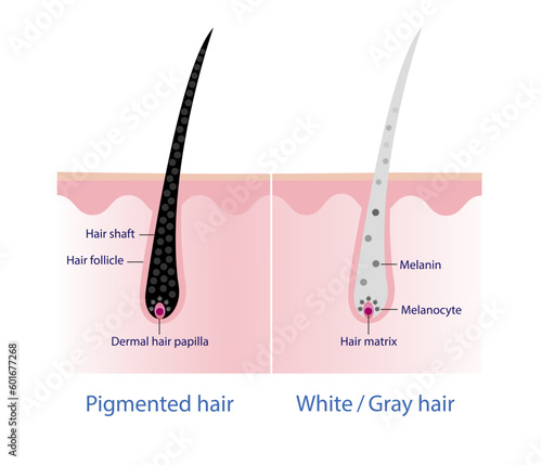 The mechanism of pigmented hair and white/ gray hair with scalp layer vector on white background. Hair anatomy, hair structure, hair care concept illustration.