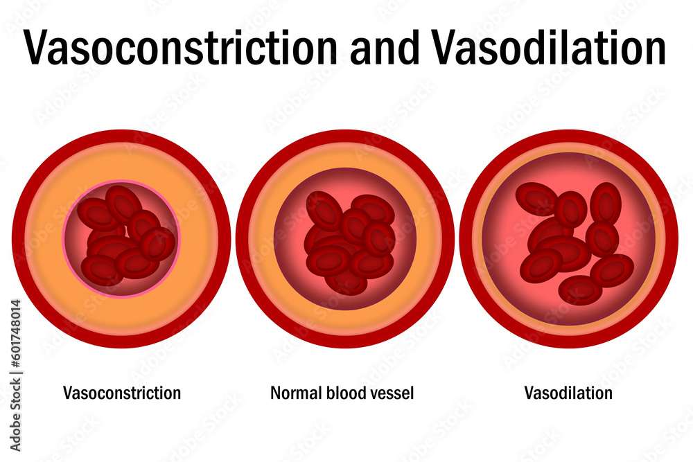 Comparison of normal, vasoconstriction and vasodilation blood vessels