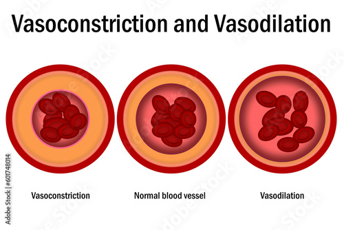 Comparison of normal, vasoconstriction and vasodilation blood vessels with cross section of arteries photo