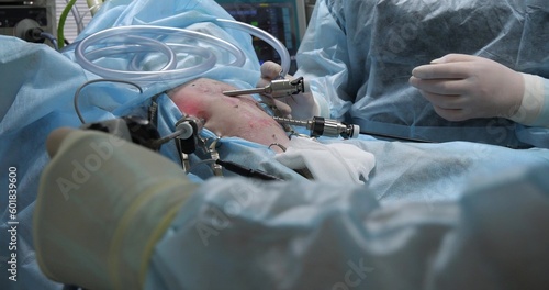 The surgeon's hands operate endoscopic instruments in the pet's abdomen during surgery. In veterinary surgery, a severe endoscopic operation is performed on a sick pet.