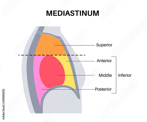 Mediastinum infographic poster