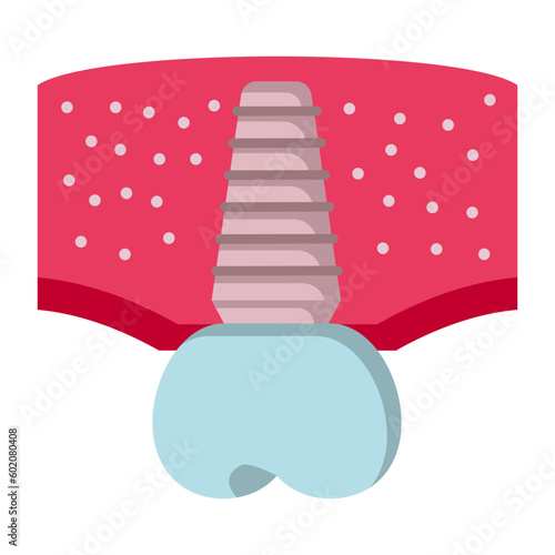 Artificial prosthetic tooth root vector color icon design, Dentistry symbol, Healthcare sign, Dental instrument stock illustration, Dental Implant concept
