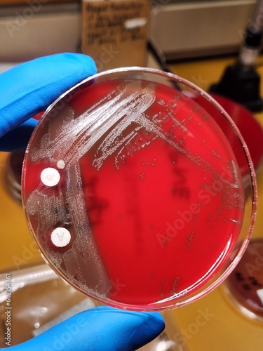 Streptococcus pneumoniae on blood agar with bacitracin and optochin discs photo