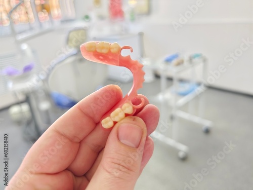 combined removable denture based on acetone and acrylic