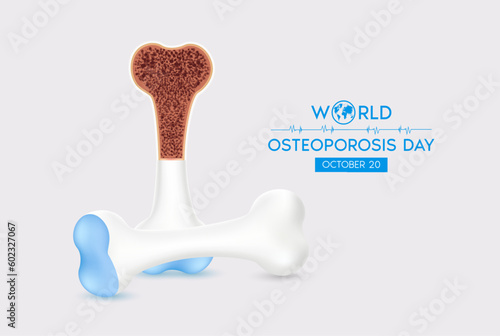 World Osteoporosis Day. Human bone anatomy. Unhealthy bone joint on a white background. Poster or banner for website. Medical or healthcare concept. Realistic 3d Vector illustration.