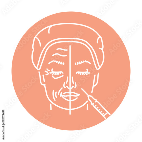 Plasmolifting therapy color line illustration. Hyaluronic injection.