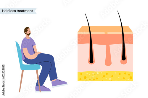 Hair loss treatment