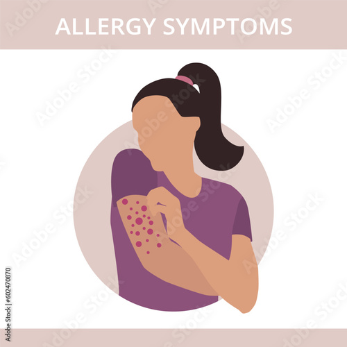 Seasonal allergy. Woman with red skin rash. Woman scratching skin on her hand