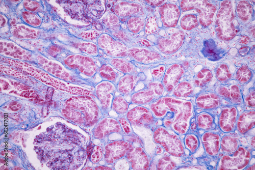 Histological Pancreas human, Liver human, Vermiform appendix human and Kidney Human under the microscope for education.