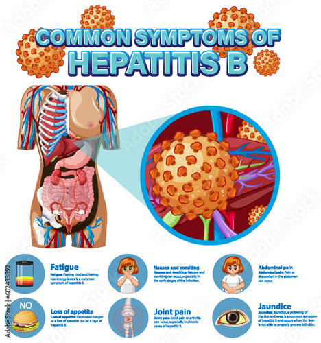 Informative poster of common symptoms Hepatitis B