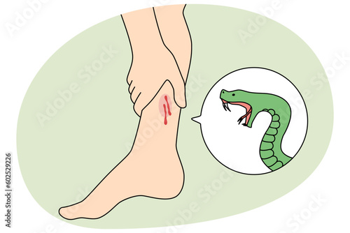 Snake bite person leg