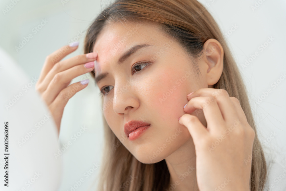 Young woman are worried about faces Dermatology and allergic to steroids in cosmetics. sensitive skin, red face from sunburn, acne, allergic to chemicals, rash on face. skin problems and beauty Young woman are worried about faces Dermatology and allergic to steroids in cosmetics. sensitive skin, red face from sunburn, acne, allergic to chemicals, rash on face. skin problems and beauty