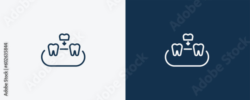 overdenture icon. Outline overdenture icon from dental health collection. Editable overdenture symbol.