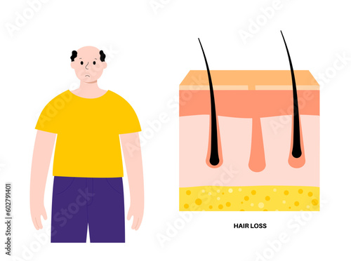 Hair loss treatment