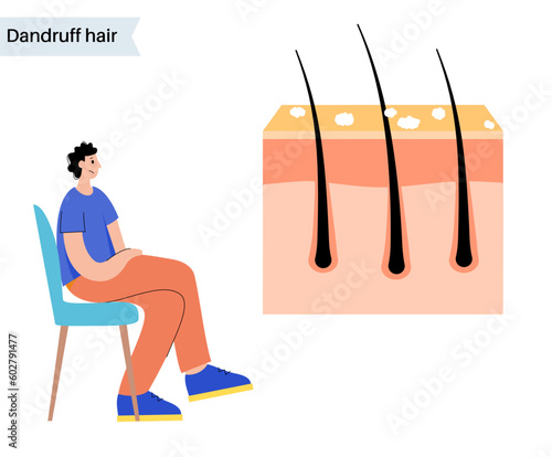 Dandruff hair treatment