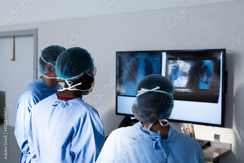 Diverse group of surgeons discussing x rays on screen in operating theatre