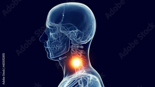 3d medical illustration of a man's skull and cervical spine. neck pain