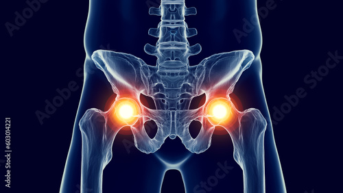 3d medical illustration of a man's pelvis. hip pain