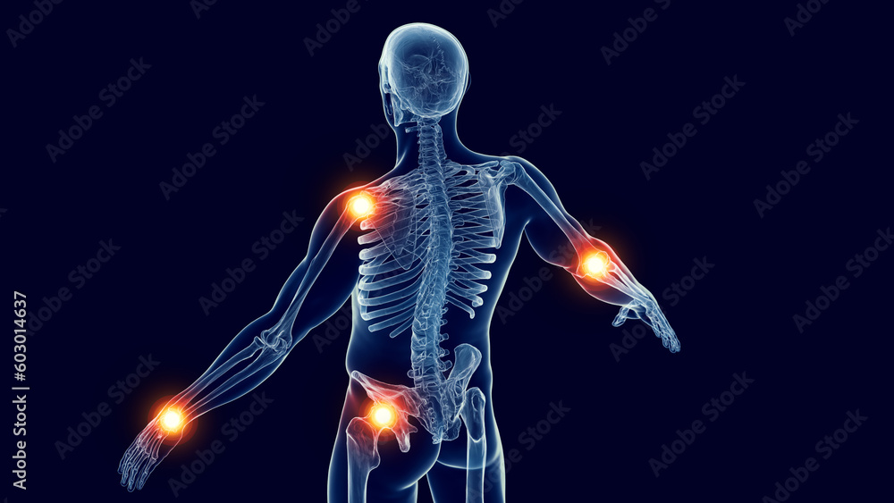 3d medical illustration of a man's joint pain