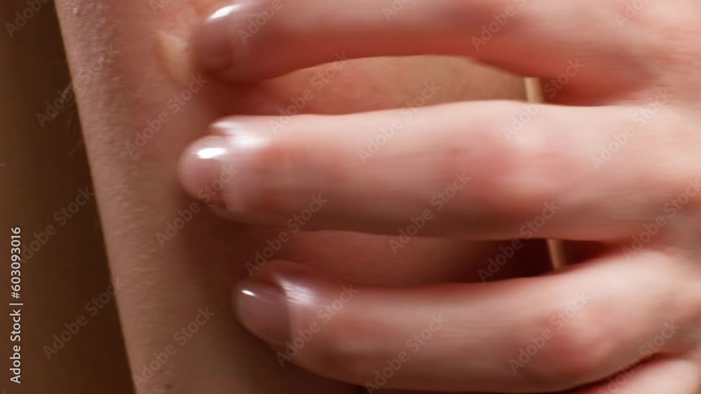 A woman's hand scratches a reddened inflamed place on the skin covered with blisters due to giardia close-up. Itching, scabies A woman's hand scratches a reddened inflamed place on the skin covered with blisters due to giardia close-up. Itching, scabies