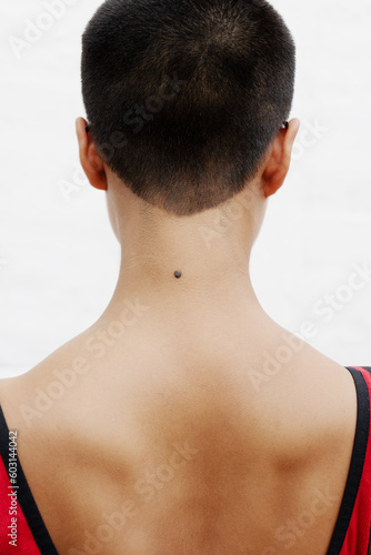 Elegance in simplicity: A bare-headed woman with a unique mole