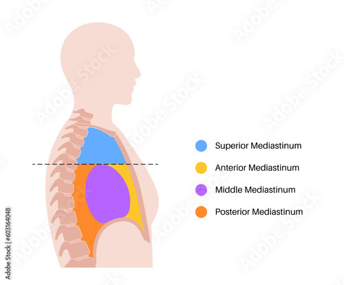 Mediastinum infographic poster