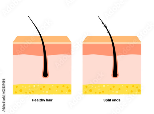 Split and normal hair