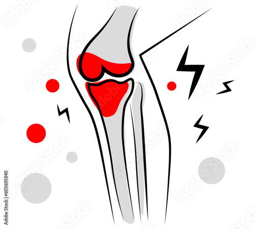 Pain in the knee. Knee joint on a white background. Vector illustration in doodle style