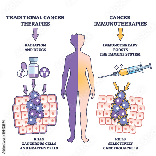 Immunotherapy method for cancer treatment for immune system outline diagram. Labeled educational scheme as medical therapy for oncology illness vector illustration. Kills selectively cancerous cells.