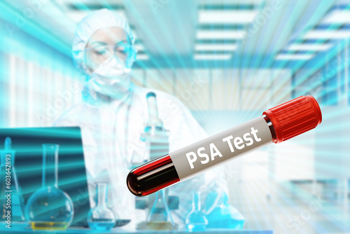 Blood for PSA test. Flask w...