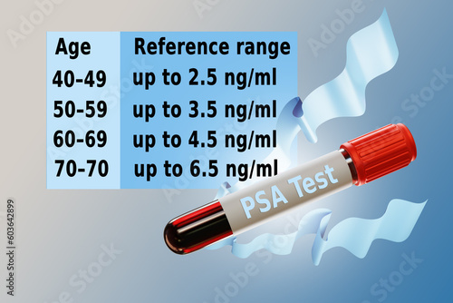 Flask for PSA test. Screeni...