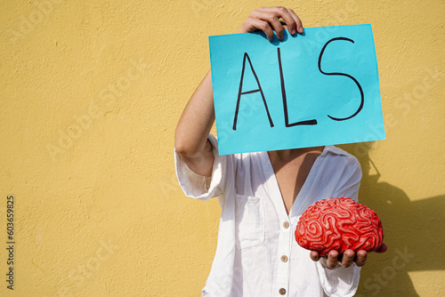 unrecognizable woman holding a als acronym card and a brain. Muscle and neurone illness. Amyotrophic Lateral Sclerosis day