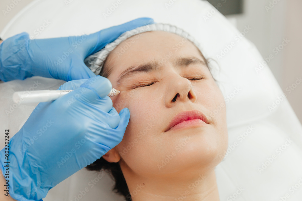 Close-up of the hands of a beautician injecting Botox into a woman's forehead. Correction of forehead and eye wrinkles with botulinum toxin.