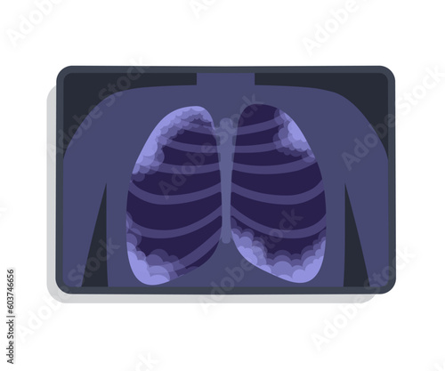 XRAY of Lungs Damaged by Pneumonia. Image of Acute Respiratory infection. Visualized by MRI or Scanner Inflammation of the Lungs. Chronic obstructive pulmonary disease vector flat illustration 