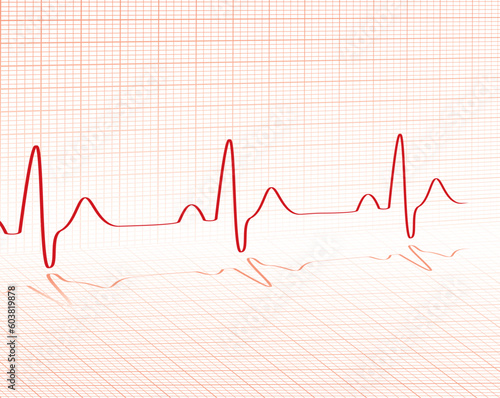 heart beat red grid layed over a background with room for your own text