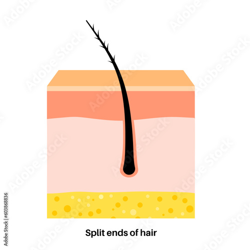 Split hair ends