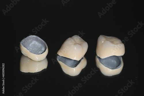 Macro shot of crowns. Dental PFM (non precious) with all porcelain baked.