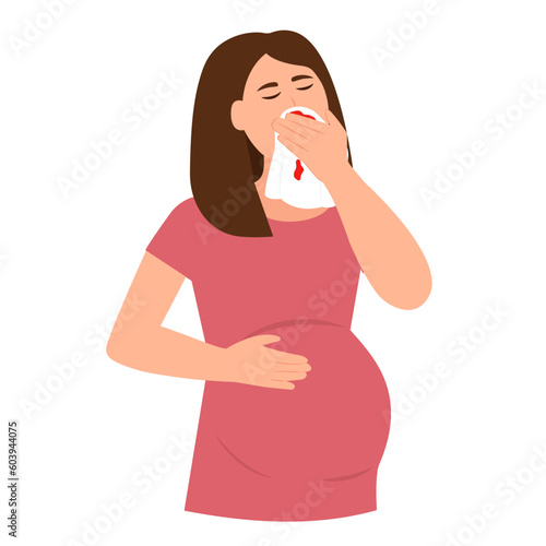 Pregnant Woman Holding Tissue or Handkerchief and Wiping Blood Off Her Nose. Nose Bleeding Symptom. Vector illustration
