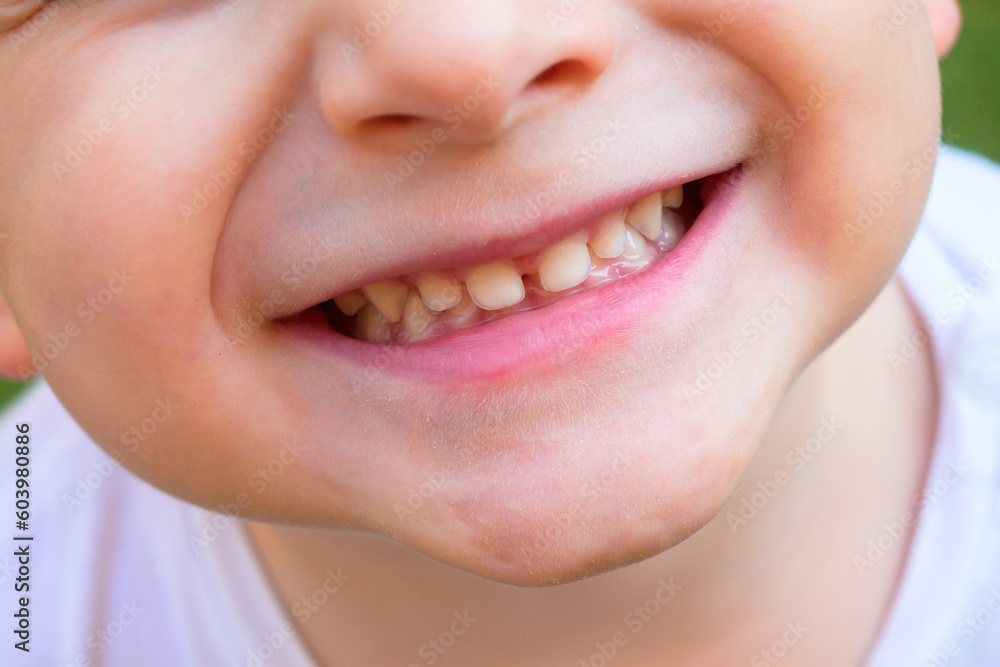 cheerful-child-2-year-old-boy-laughing-close-up-of-part-of-the-child
