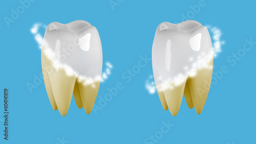 3d tooth whitening hygiene icon. Dental plaque cleaning with laser, toothpaste, for cavity protection, shiny bright smile, enamel care.