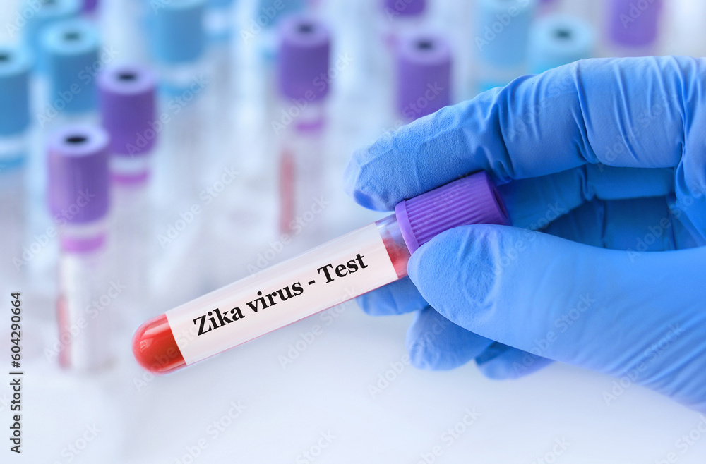 Doctor holding a test blood sample tube with Zika virus test on the background of medical test tubes with analyzes.
